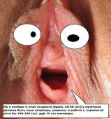 161