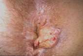 58