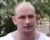 99
