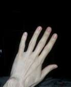93