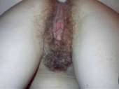 36