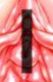 77