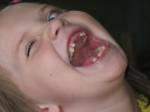34