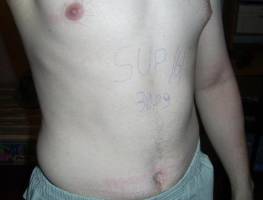 30