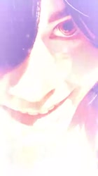300x532
