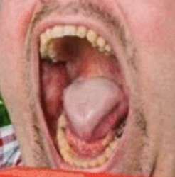 336x341