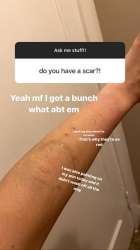 828x1472