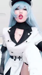 720x1280
