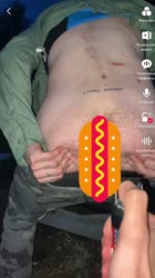 720x1280