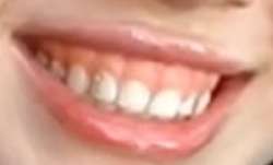 255x155