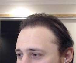 296x246