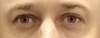 100x38