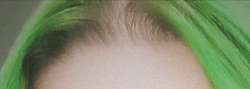 720x259