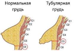 400x274