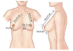 641x450