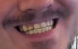 395x250