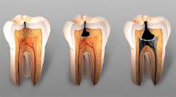 550x305