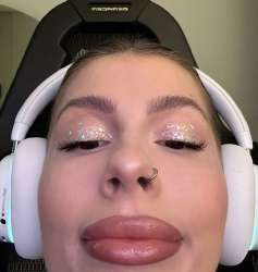 736x776