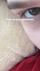 720x1278
