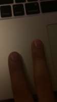 720x1278