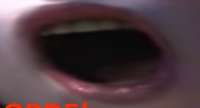 395x215